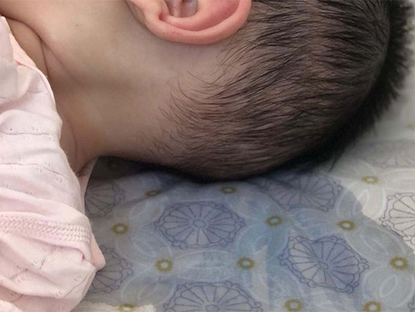 頭部經常出汗什么原因,頭部出汗多怎么調理